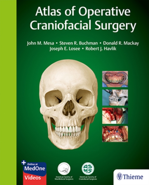 Atlas of Operative Craniofacial Surgery, Multiple-component retail product, part(s) enclose Book