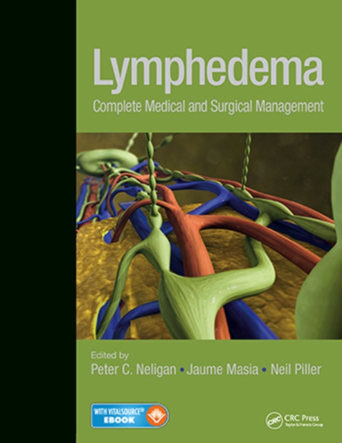 Lymphedema : Complete Medical and Surgical Management, Hardback Book