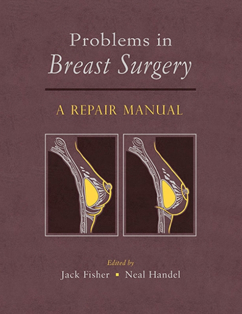 Problems in Breast Surgery : A Repair Manual, Multiple-component retail product, part(s) enclose Book