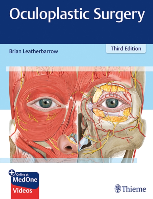 Oculoplastic Surgery, Multiple-component retail product, part(s) enclose Book