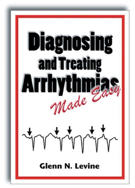 Diagnosing and Treating Arrhythmias Made Easy, Paperback / softback Book