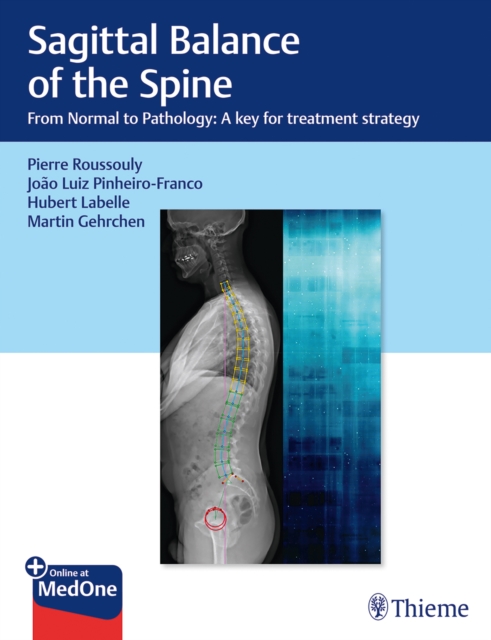 Sagittal Balance of the Spine : From Normal to Pathology: A Key for Treatment Strategy, Multiple-component retail product, part(s) enclose Book
