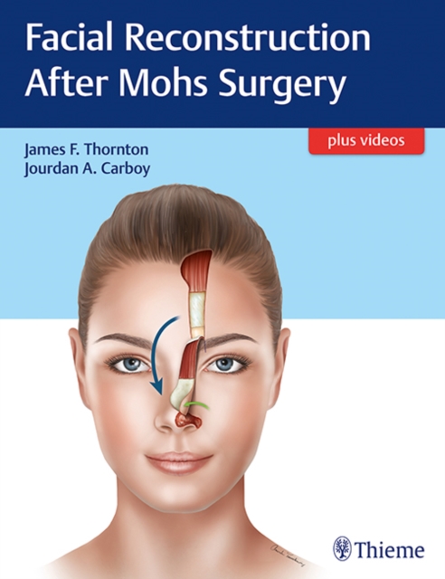Facial Reconstruction After Mohs Surgery, Multiple-component retail product, part(s) enclose Book