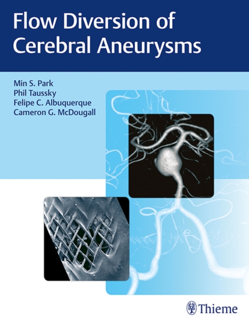 Flow Diversion of Cerebral Aneurysms, Hardback Book