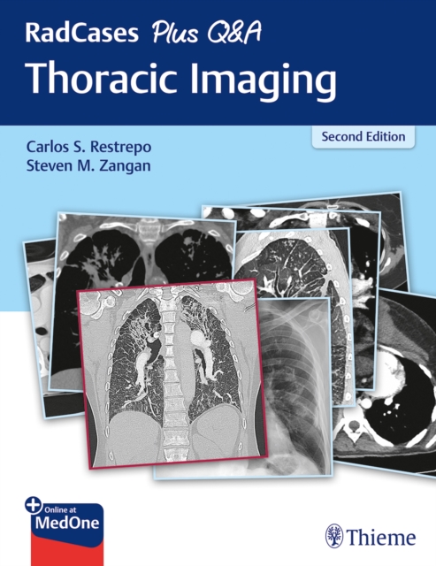 RadCases Plus Q&A Thoracic Imaging, Paperback / softback Book