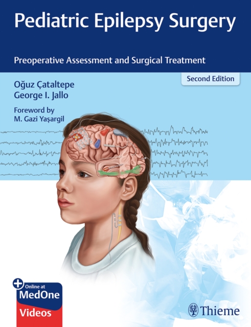Pediatric Epilepsy Surgery : Preoperative Assessment and Surgical Treatment, Multiple-component retail product, part(s) enclose Book