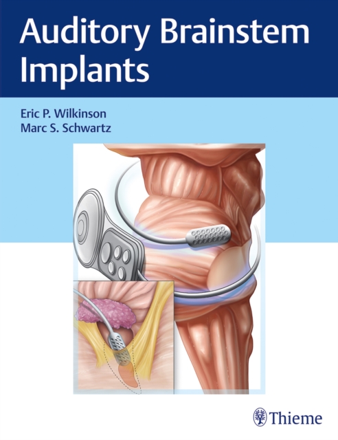 Auditory Brainstem Implants, Multiple-component retail product, part(s) enclose Book