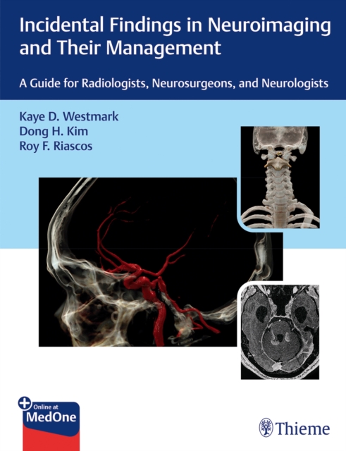 Incidental Findings in Neuroimaging and Their Management : A Guide for Radiologists, Neurosurgeons, and Neurologists, Multiple-component retail product, part(s) enclose Book
