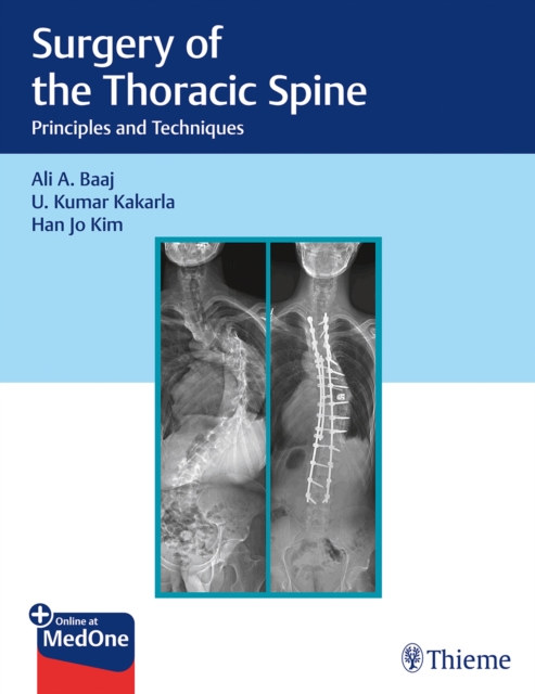 Surgery of the Thoracic Spine : Principles and Techniques, Multiple-component retail product, part(s) enclose Book