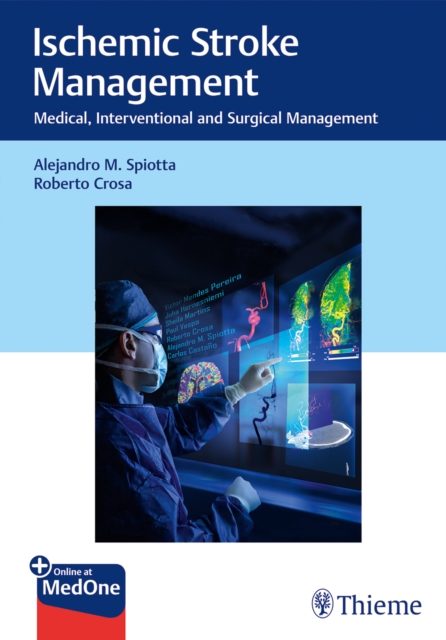 Ischemic Stroke Management : Medical, Interventional and Surgical Management, Mixed media product Book