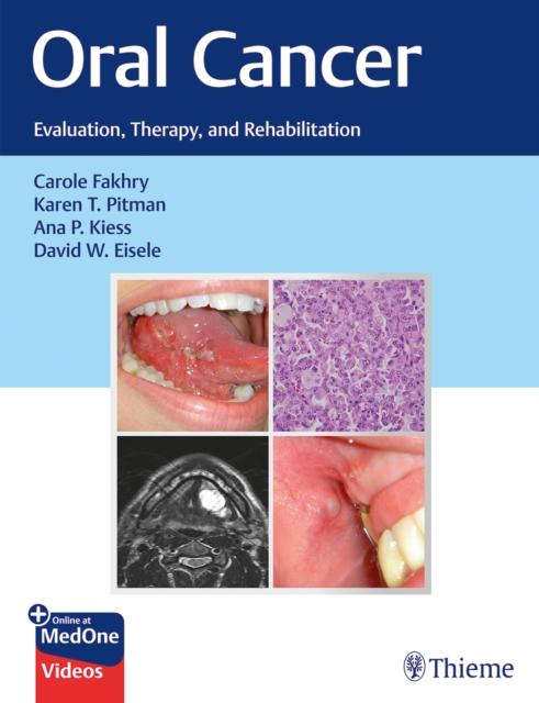 Oral Cancer : Evaluation, Therapy, and Rehabilitation, Multiple-component retail product, part(s) enclose Book