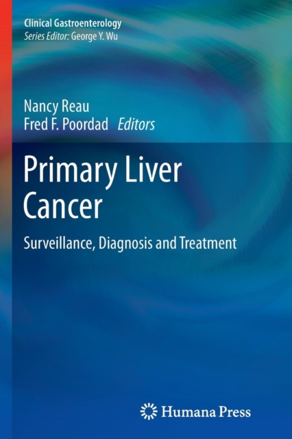 Primary Liver Cancer : Surveillance, Diagnosis and Treatment, Paperback / softback Book