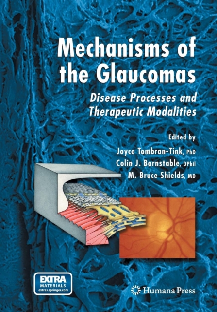 Mechanisms of the Glaucomas : Disease Processes and Therapeutic Modalities, Paperback / softback Book