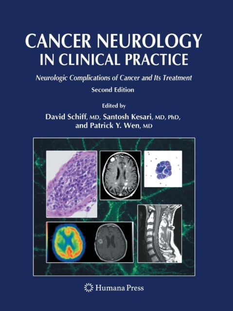 Cancer Neurology in Clinical Practice : Neurologic Complications of Cancer and Its Treatment, Paperback / softback Book