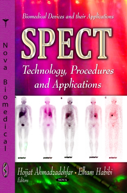 SPECT : Technology, Procedures and Applications, PDF eBook