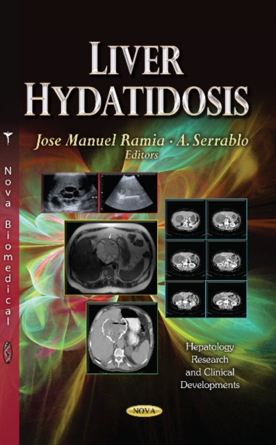 Liver Hydatidosis, Hardback Book