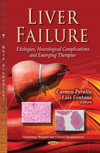 Liver Failure : Etiologies, Neurological Complications & Emerging Therapies, Hardback Book