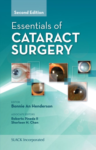 Essentials of Cataract Surgery, Second Edition, EPUB eBook