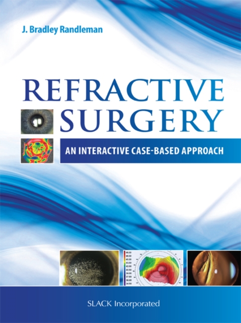 Refractive Surgery : An Interactive Case-Based Approach, PDF eBook