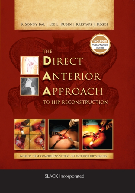 The Direct Anterior Approach to Hip Reconstruction, Hardback Book