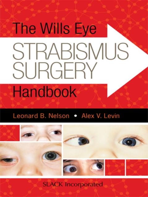 The Wills Eye Strabismus Surgery Handbook, EPUB eBook