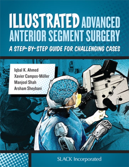 Illustrated Advanced Anterior Segment Surgery : A Step-by-Step Guide for Challenging Cases, Hardback Book