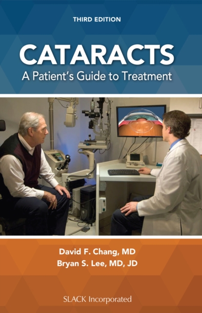 Cataracts : A Patient's Guide to Treatment, Paperback / softback Book