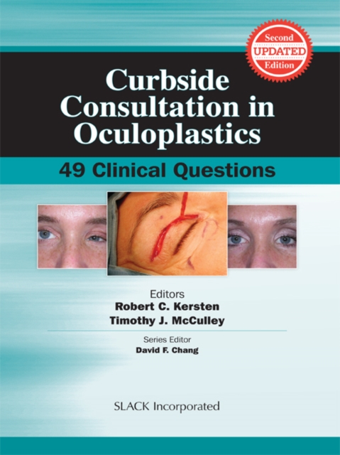 Curbside Consultation in Oculoplastics : 49 Clinical Questions, Second Edition, EPUB eBook