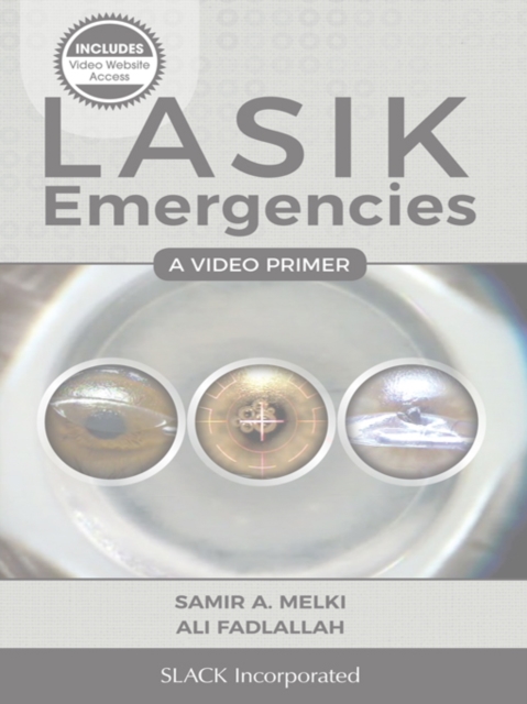 LASIK Emergencies : A Video Primer, EPUB eBook