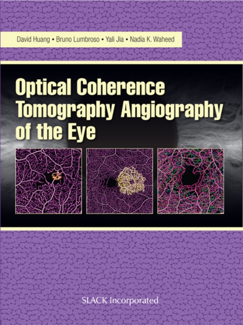 Optical Coherencre Tomography Angiography of the Eye, PDF eBook