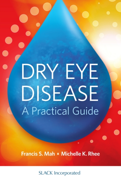 Dry Eye Disease : A Practical Guide, Paperback / softback Book