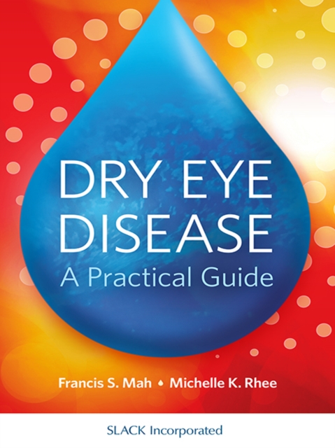 Dry Eye Disease : A Practical Guide, EPUB eBook