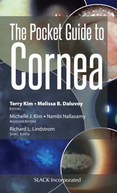 The Pocket Guide to Cornea, Paperback / softback Book