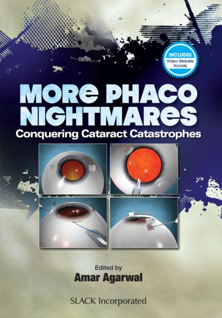 More Phaco Nightmares : Conquering Cataract Catastrophes, Hardback Book
