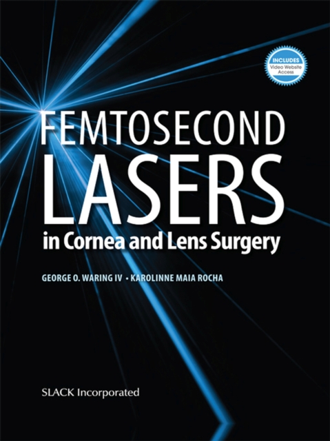 Femtosecond Lasers in Cornea and Lens Surgery, Hardback Book