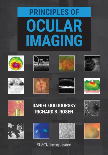 Principles of Ocular Imaging, Hardback Book