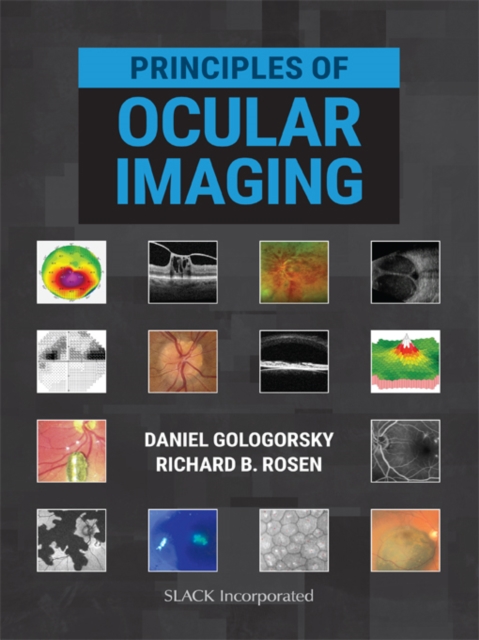 Principles of Ocular Imaging, EPUB eBook