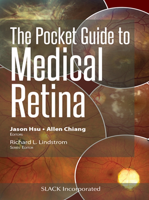 The Pocket Guide to Medical Retina, EPUB eBook