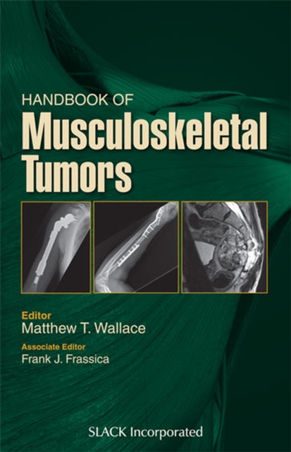 Handbook of Musculoskeletal Tumors, Paperback / softback Book