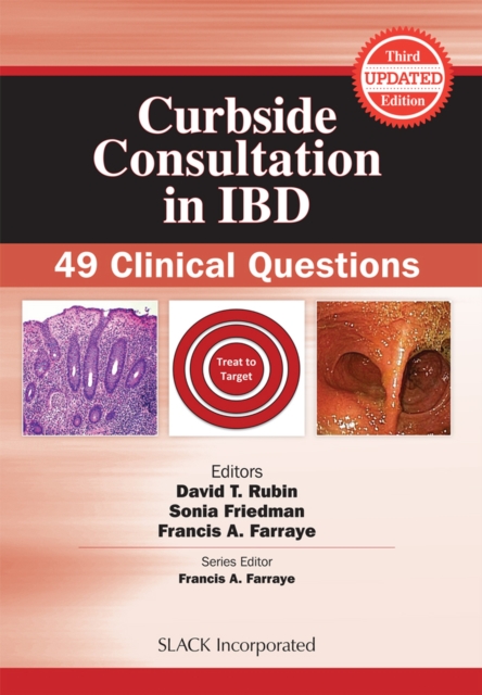 Curbside Consultation in IBD : 49 Clinical Questions, Paperback / softback Book