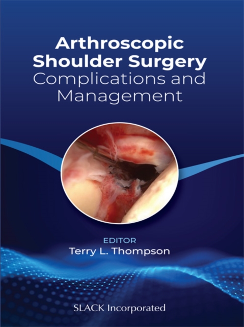 Arthroscopic Shoulder Surgery : Complications and Management, EPUB eBook