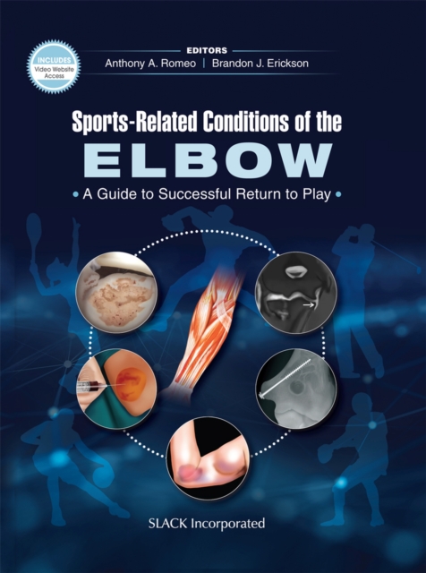 Sports-Related Conditions of the Elbow : A Guide to Successful Return to Play, Hardback Book