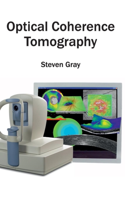 Optical Coherence Tomography, Hardback Book