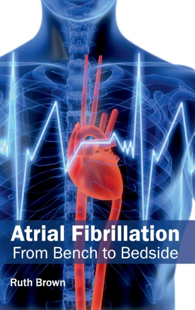 Atrial Fibrillation: From Bench to Bedside, Hardback Book