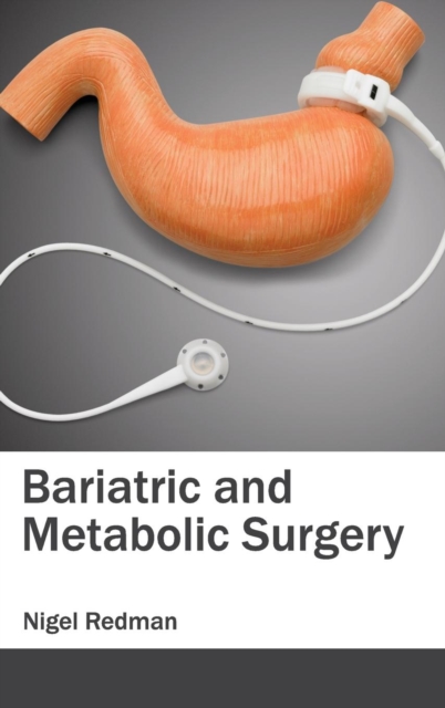 Bariatric and Metabolic Surgery, Hardback Book