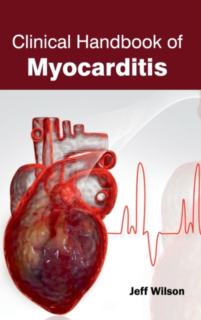 Clinical Handbook of Myocarditis, Hardback Book