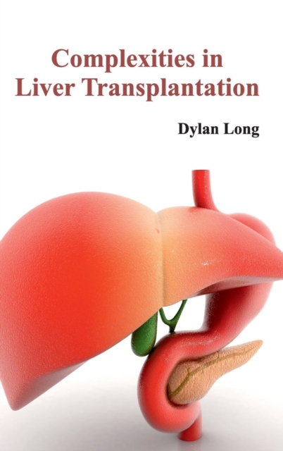 Complexities in Liver Transplantation, Hardback Book