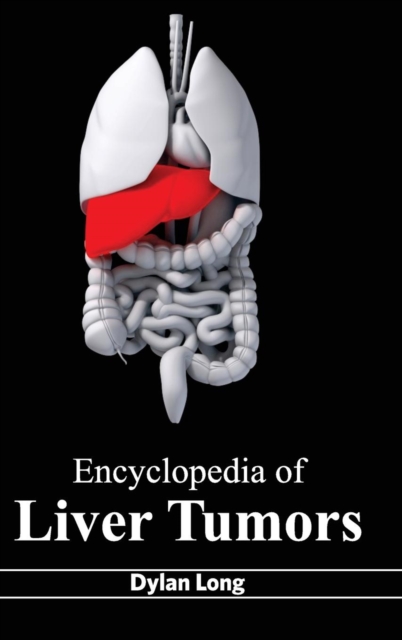 Encyclopedia of Liver Tumors, Hardback Book