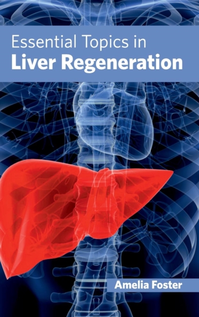 Essential Topics in Liver Regeneration, Hardback Book