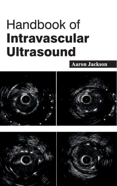 Handbook of Intravascular Ultrasound, Hardback Book